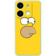 Чехол BoxFace Infinix Smart 7 HD 