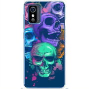 Чехол BoxFace ZTE Blade L9 