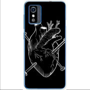 Чехол BoxFace ZTE Blade L9 