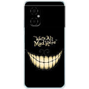 Чехол BoxFace Xiaomi Poco M4 5G 