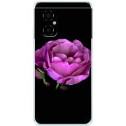 Чехол BoxFace Xiaomi Poco M4 5G 