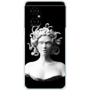 Чехол BoxFace Xiaomi Poco M4 5G 