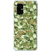 Чехол BoxFace Xiaomi Poco M4 5G 