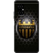 Черный чехол BoxFace Poco M4 5G 