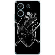 Чехол BoxFace Xiaomi Redmi Note 13 Pro 5G 