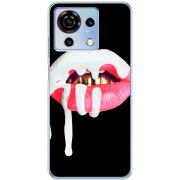 Чехол BoxFace ZTE Blade V50 Vita 