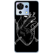 Чехол BoxFace ZTE Blade V50 Vita 