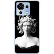 Чехол BoxFace ZTE Blade V50 Vita 