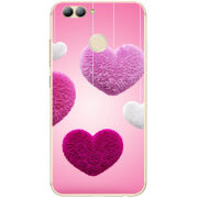 Чехол Uprint Huawei Nova 2 