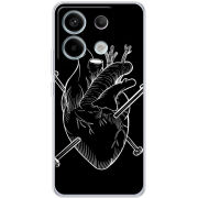 Чехол BoxFace Xiaomi Redmi Note 13 5G 