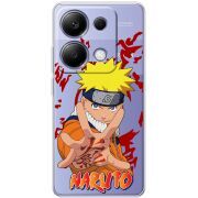 Прозрачный чехол BoxFace Xiaomi Redmi Note 13 Pro 4G Naruto