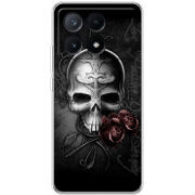Чехол BoxFace Xiaomi Poco X6 Pro 5G 