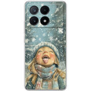 Чехол BoxFace Xiaomi Poco X6 Pro 5G Смак дитинства