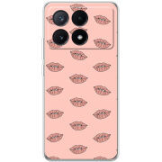 Чехол BoxFace Xiaomi Poco X6 Pro 5G 