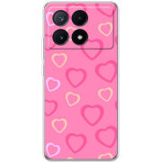 Чехол BoxFace Xiaomi Poco X6 Pro 5G Sugar Hearts