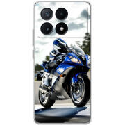 Чехол BoxFace Xiaomi Poco X6 Pro 5G 