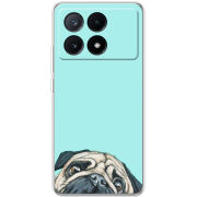 Чехол BoxFace Xiaomi Poco X6 Pro 5G 