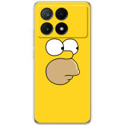 Чехол BoxFace Xiaomi Poco X6 Pro 5G 