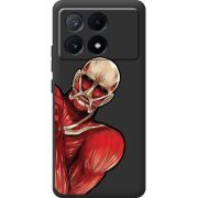 Черный чехол BoxFace Poco X6 Pro 5G Титан