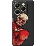 Черный чехол BoxFace Infinix Hot 40 Титан