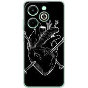 Чехол BoxFace Infinix Hot 40i 
