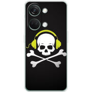 Чехол BoxFace OnePlus Nord 3 5G 