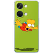 Чехол BoxFace OnePlus Nord 3 5G 