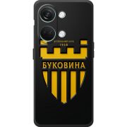 Черный чехол BoxFace OnePlus Nord 3 5G 
