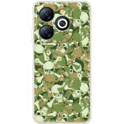 Чехол BoxFace Infinix Smart 8 Plus 