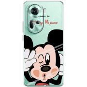 Прозрачный чехол BoxFace OPPO Reno 11 5G Mister M