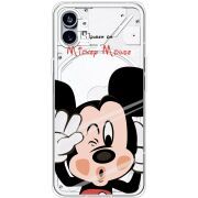 Прозрачный чехол BoxFace Nothing Phone (1) Mister M