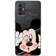 Прозрачный чехол BoxFace TCL 306 Mister M