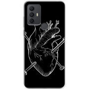 Чехол BoxFace TCL 30 SE 