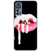 Чехол BoxFace TCL 30 Plus 