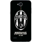 Чехол Uprint LG X Power 2 M320 