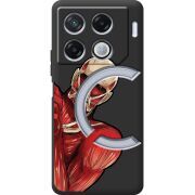 Черный чехол BoxFace Infinix GT 20 Pro Титан