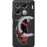 Черный чехол BoxFace Infinix GT 20 Pro Нападение на Титана