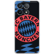 Чехол BoxFace Poco F6 Pro FC Bayern