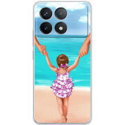 Чехол BoxFace Poco F6 Pro Happy child