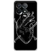 Чехол BoxFace Poco F6 Pro 