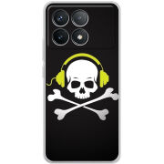 Чехол BoxFace Poco F6 Pro 