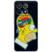 Чехол BoxFace Poco F6 Pro 