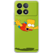 Чехол BoxFace Poco F6 Pro 