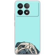 Чехол BoxFace Poco F6 Pro 