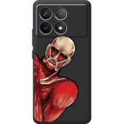 Черный чехол BoxFace Poco F6 Pro Титан