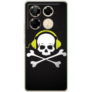Чехол BoxFace Infinix Note 40 Pro 