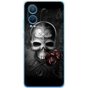 Чехол BoxFace OnePlus Nord CE 4 Lite 5G 