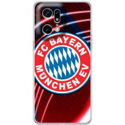 Чехол BoxFace OPPO Find X5 Pro 