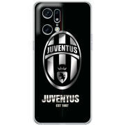 Чехол BoxFace OPPO Find X5 Pro 