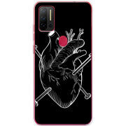 Чехол BoxFace Ulefone Note 11P 